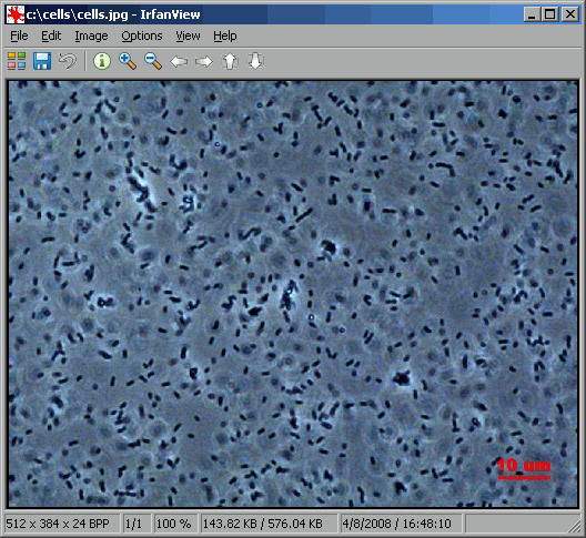 Count cells from digital camera for microscope.